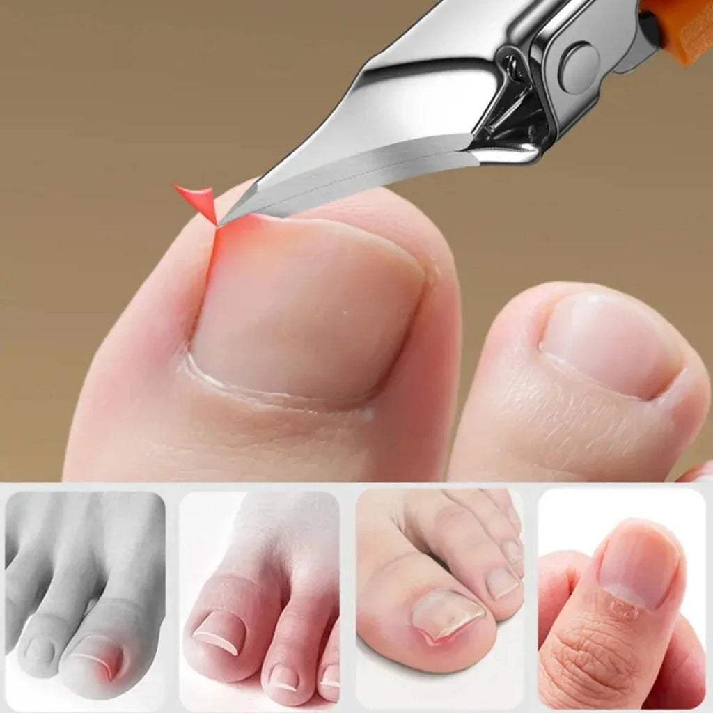 Edge Nail Clipper Wide Opening Stainless Steel, Professional Ingrown Toenail Tools, Eagle Beak Toe Trimmer