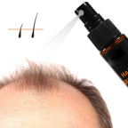 Hair Re-Growth Herbal Essence Spray
