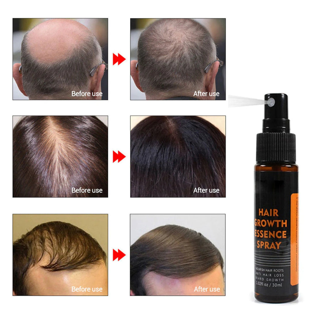 Hair Re-Growth Herbal Essence Spray